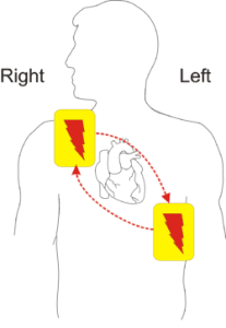 AED guide